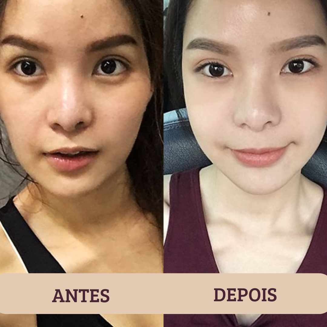 Before and after - Julia